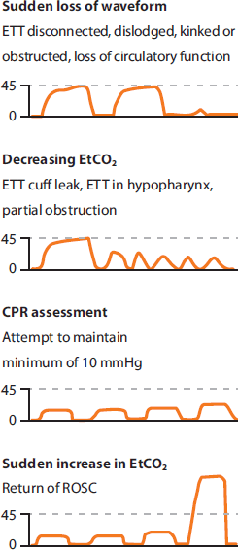 Capnography Provides Bigger Physiological Picture To Maximize Patient Care Jems Ems