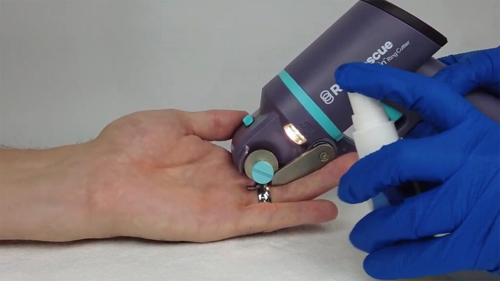 A Novel Cutting Device for Ring Removal: Case Study - JEMS: EMS, Emergency  Medical Services - Training, Paramedic, EMT News